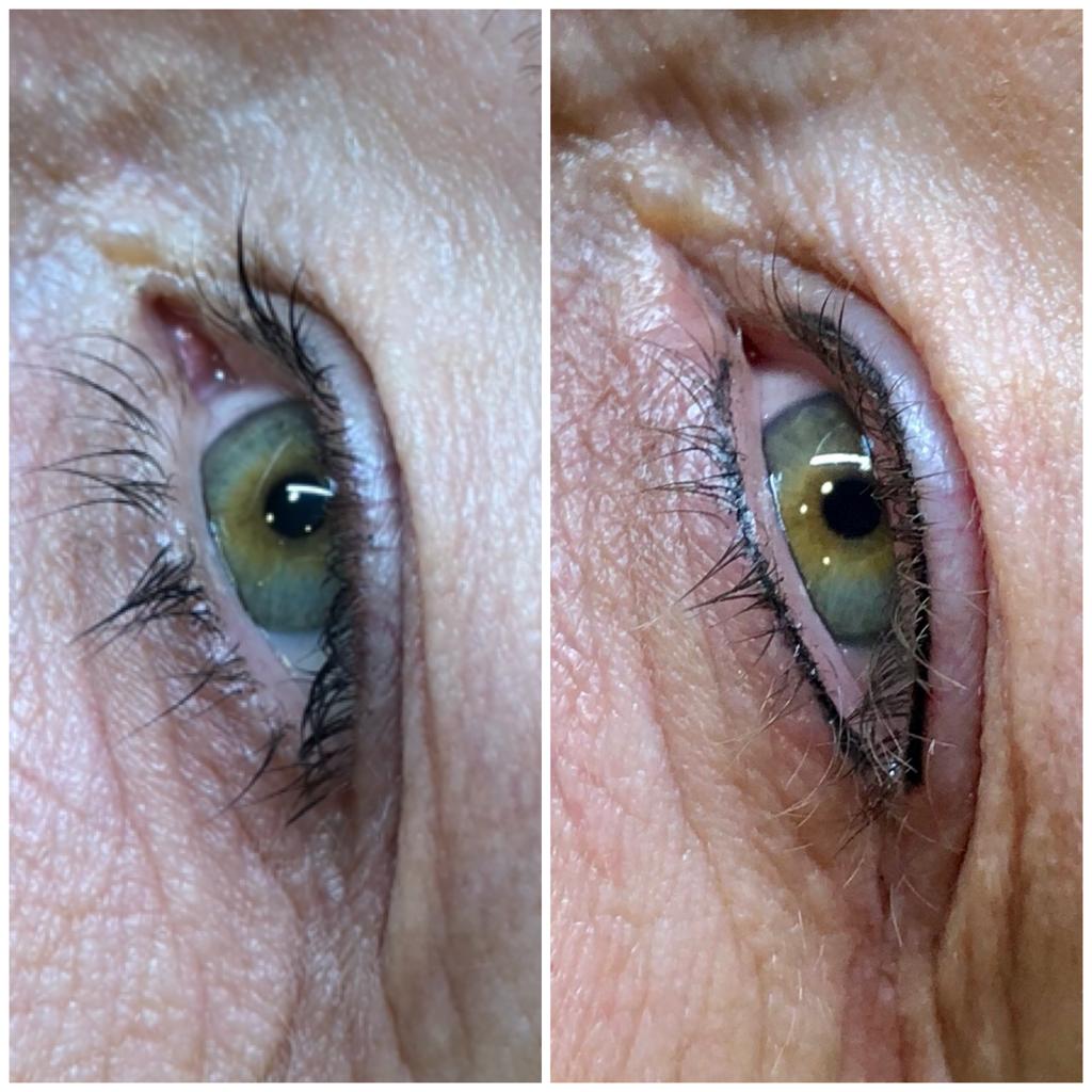 Permanent Eyeliner Before and After Photos